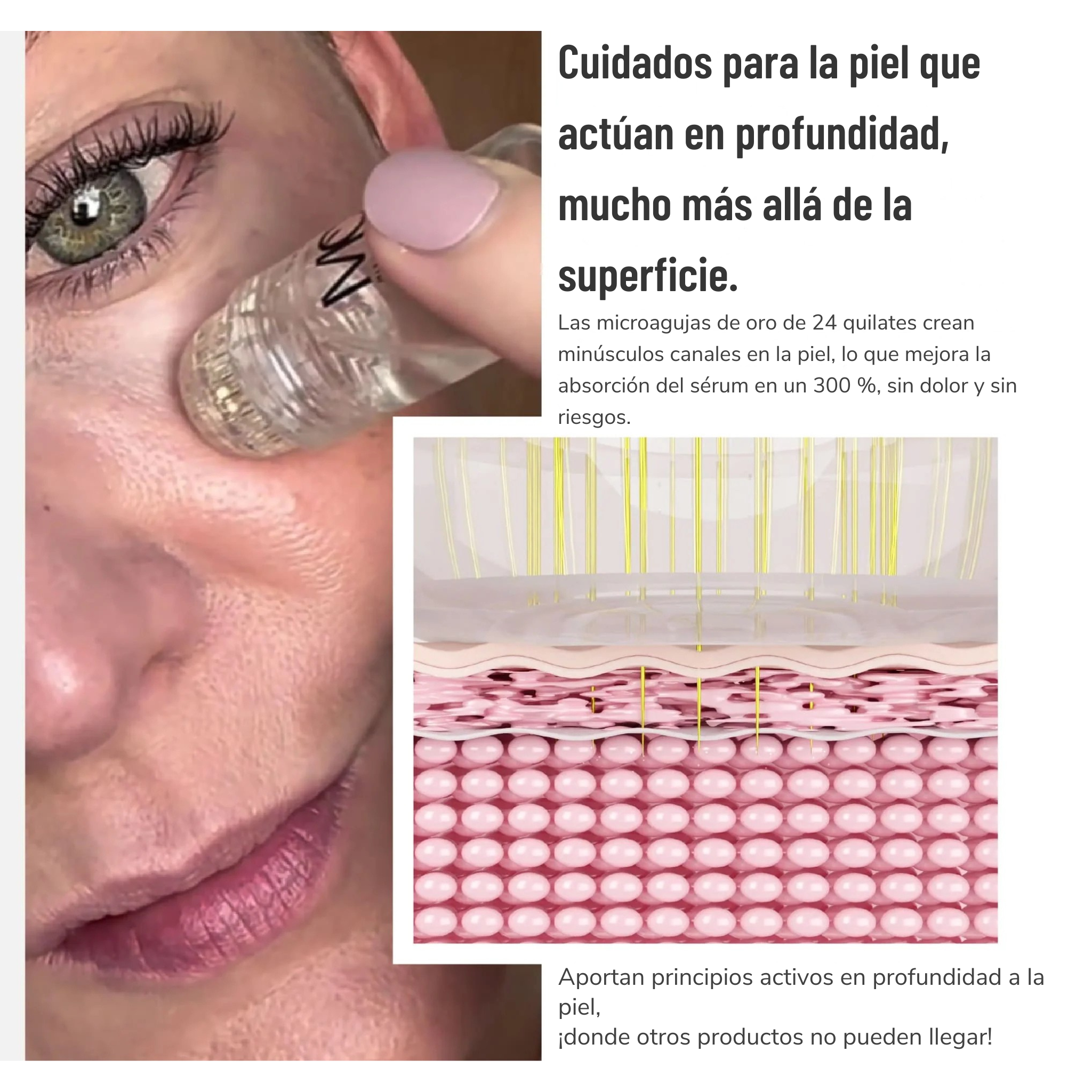 Miski Micro Infusion System ES