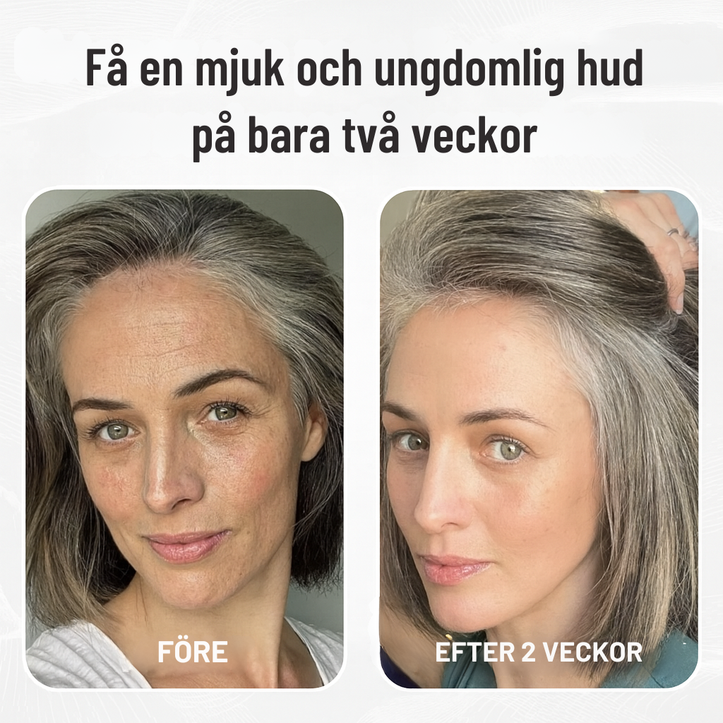 Mikro-Infusionssystem SE