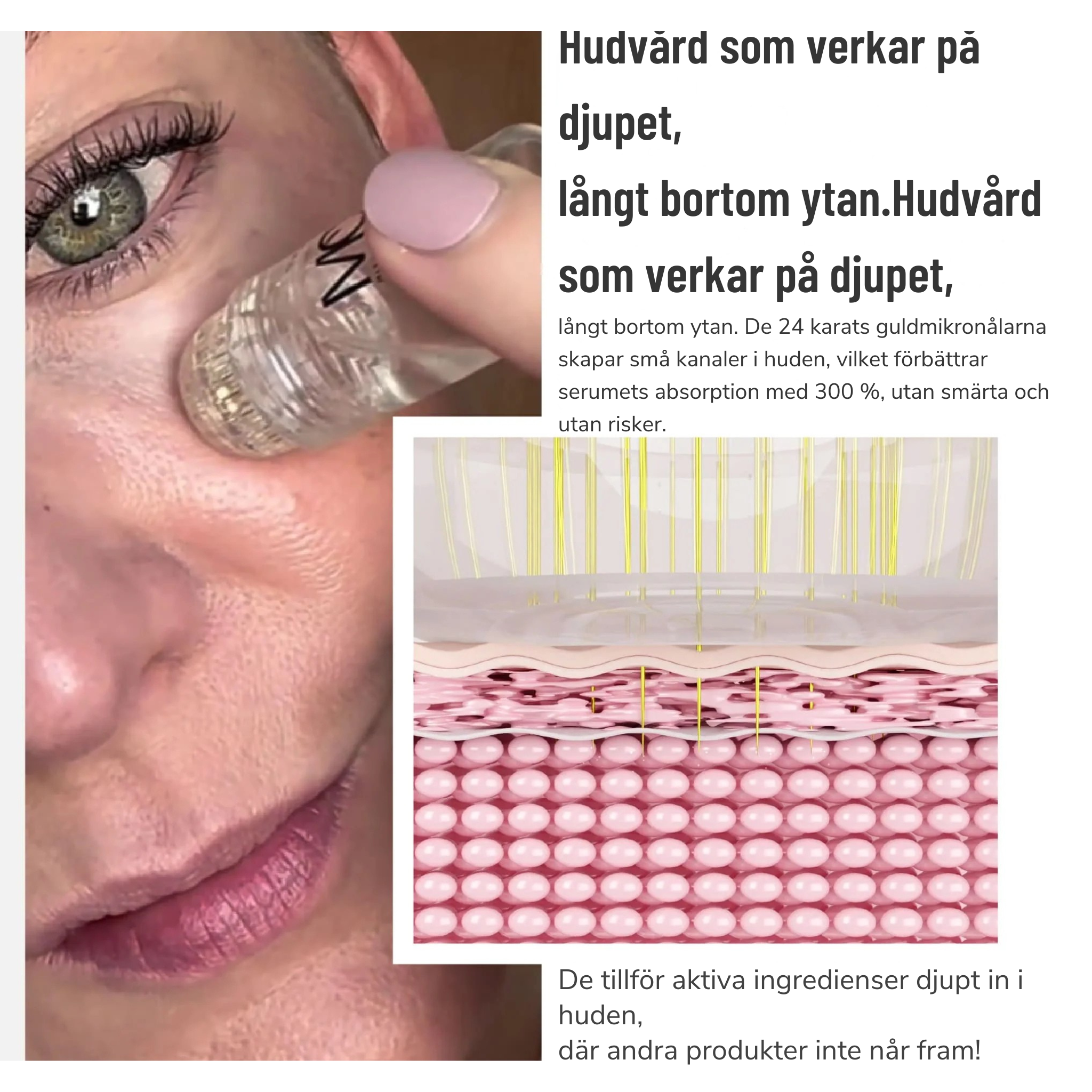 Mikro-Infusionssystem SE